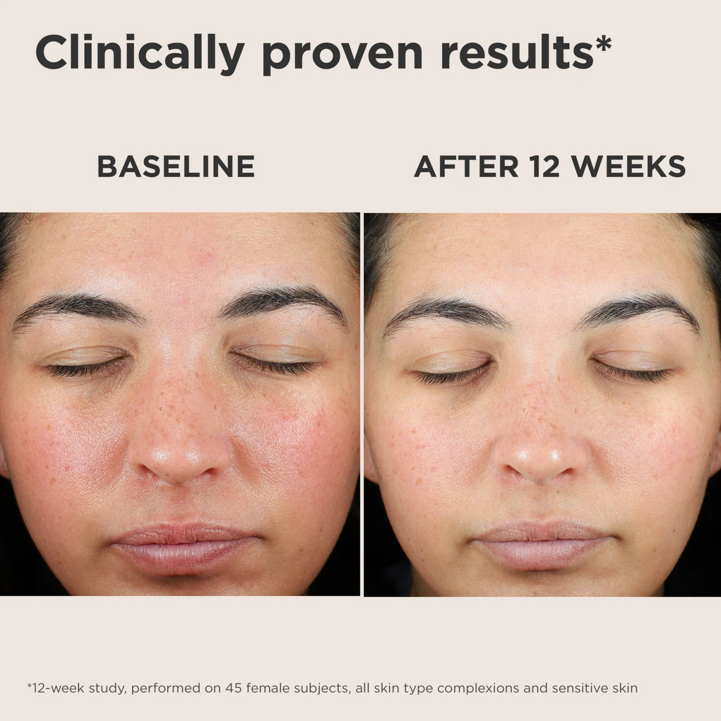 EltaMD UV Skin Recovery Red Color Correcting Green Tint Broad Spectrum SPF 50