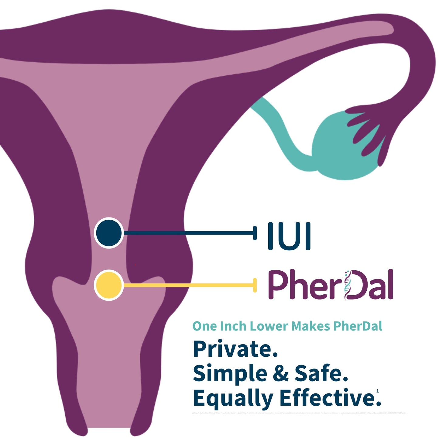PherDal At Home Insemination Kit - 3 pack, Patented, Sterile, FDA cleared