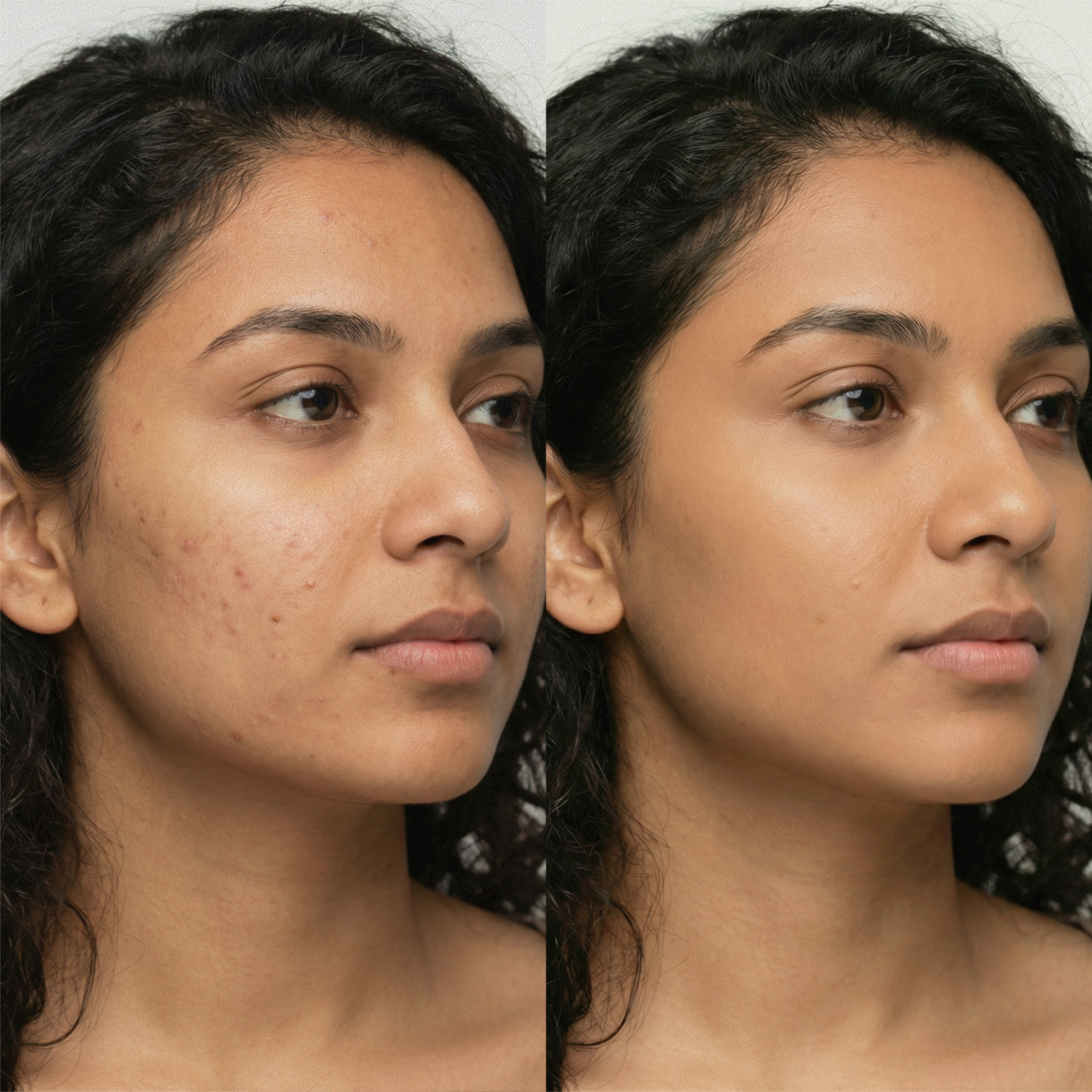 AMAZING CONCEALER